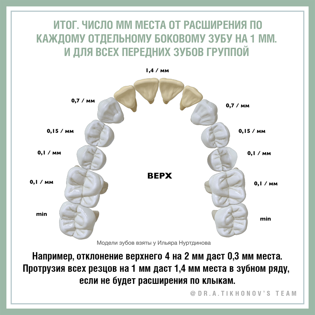 Главные задачи ортодонтии: дефицит места. - интересно об ортодонтии,  имплантации и протезировании зубов